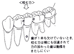 義歯設計の困難性 2