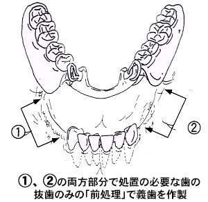 治療例１