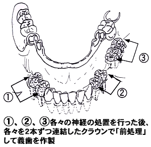 治療例２