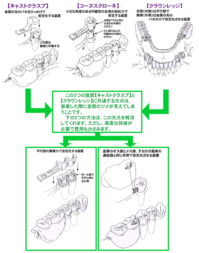 維持装置